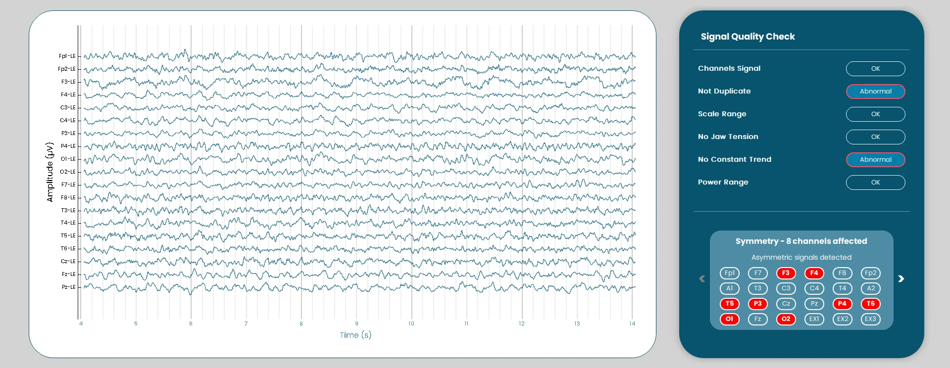 Alpha Software Interface 2