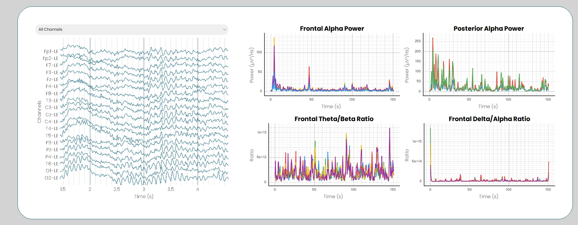 Alpha Software Interface 3